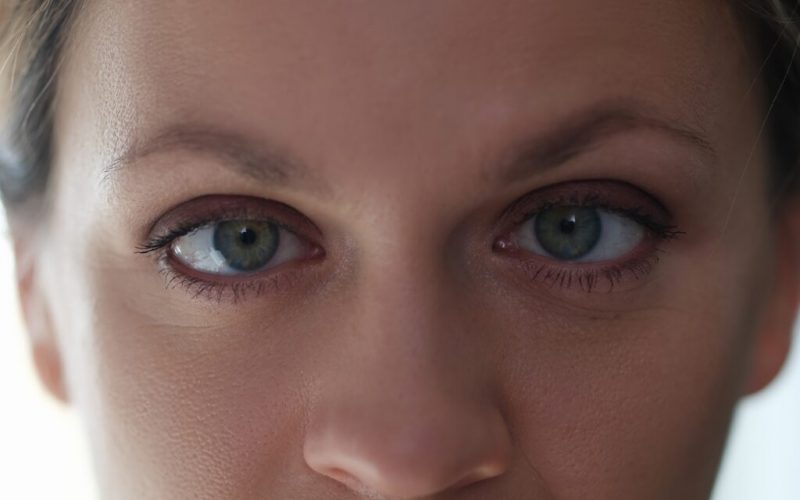 Woman with amblyopia or lazy eye